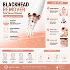 5 in 1 Rechargeable Blackhead Remover Vacuum | USB Electric Pore Cleaner